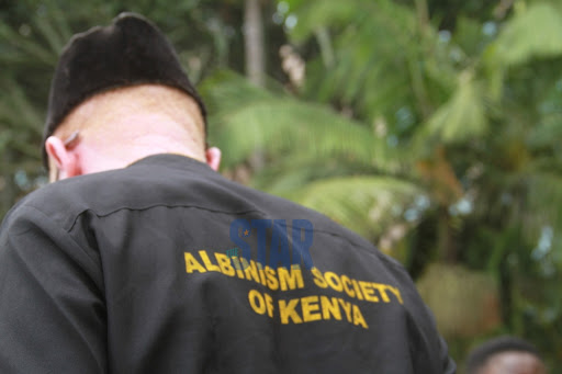 A member of the Albinism Society of Kenya.